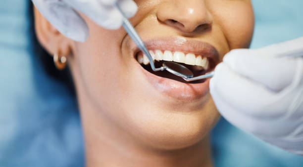 Best Emergency Tooth Extraction in Kulpsville, PA